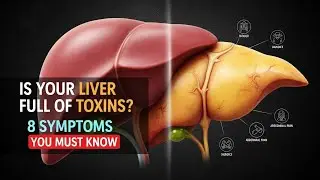 Is Your Liver Full of Toxins? 8 Symptoms You Must Know