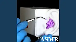 Intense and Sensitive Ear Cleaning Triggers Pt.2