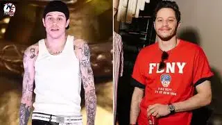 Pete Davidson Shows Off Nearly Bare Arms Saying He Was in the Process of Removing His Tattoos