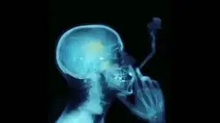 The act of smoking shown as an X-ray