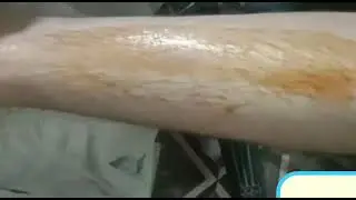 Home to make  wax sugar wax tutorial for hair removal
