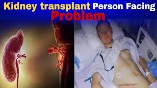 Kaise kidney transplant vyakti khud Ko recover Kiya