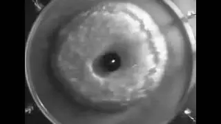 Shallow water analog of shocks in stellar explosions. Part 2