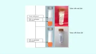 PROMOTE: Steps Involved In Stool Donation