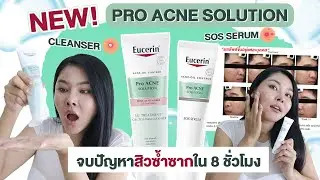 (กูรูเช็ค)  EUCERIN SOS SERUM และ 3X Treatment Gel to Foam Cleanser จบทุกสิวซ้ำซาก ใน 8 ชม.