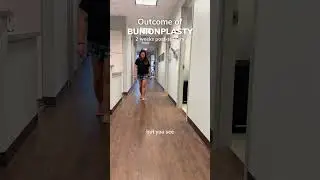 Walking Just 2 Weeks After Bunionplasty&reg; Surgery | Dr. Justin Kane - OINT