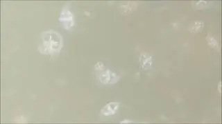 Water Wonders: Freshwater Jellyfish