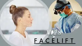 Face Lift