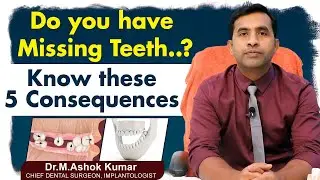 5 Consequences of Not Replacing Missing Teeth | Solution For Missing Teeth | Eledent Dental Hospital