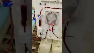 #dialysis #dialysisinhindi #ckdpatient #phonk #phonkmusic #remix #art #dialysis #ivcannulation