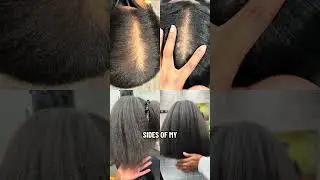 Side-by-side comparison of Black Girl Vitamins vs Mary Ruth #naturalhair #hairstylist