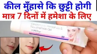 Clinsol gel review | Clinsol gel review in hindi | Clinsol gel how to use | Clinsol gel 