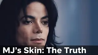 Michael Jackson&rsquo;s Skin: The Story the Media Got Wrong