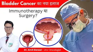 Bladder Cancer क्या है? Immunotherapy vs Surgery &ndash; कौन सा इलाज है Best & Safe? Dr. Amit Bansal