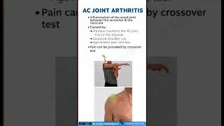 AC Joint Arthritis, Dr. Arslan Yasin Sukhera Physiotherapist #anatomy #physiotherapy #biology