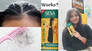 I applied Sesa Ayurvedic hair oil for 21 days.Worst experience? How to use sesa oil . Honest opinion