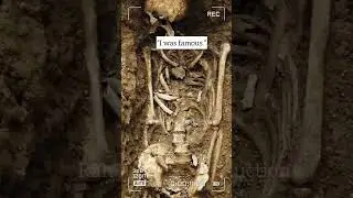 Sad Reality of Human Death || Heart Melting  Reality💔💔Subscribe plz😐 || Million word in One Picture.