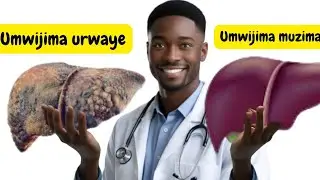Nta Kabuza Urwaye Umwijima niba ufite ibi bimenyetso 10