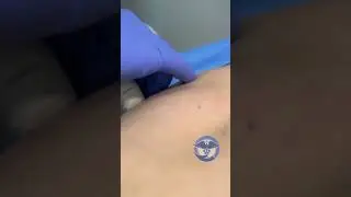 UMD: Elastografia Hep&aacute;tica
