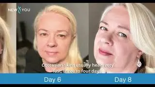 Fabulous Face Fix | New You Cosmetic Centres