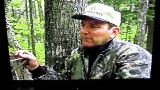 Stepp ladder...best tree climbing system in the world sir