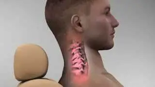TMJ Pain After Auto Injury