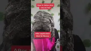 Learn how to Detox natural hair |cleanse dandruff permanently #shorts extreme hair growth