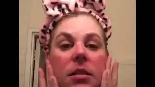 facial resurfacer