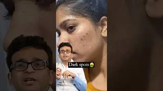 How to get rid of Dark spots ?