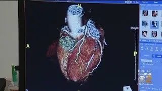 Coronavirus Can Have Lasting Effects On Heart, Lungs New Research Says