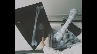 Bone Bank 06102024