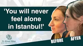 'You will never feel alone!' Olga's Rhinoplasty Adventure In Istanbul!  Dr. Ahmet Dilber