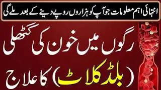 Blood Clot Treatment | Ragoon Mn Khoon Jamnay Ka Ilaj | Recommended Treatment For Blood Clot in urdu