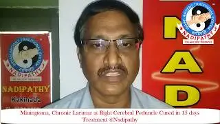 Miningioma, Chronic Lacunar at Right Cerebral Peduncle Cured in 15 days Treatment @Nadipathy