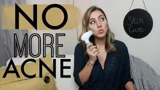 My Updated Skincare Routine | Acne-Prone + Scar Treatment