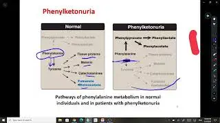 lec 5 inborn error in metabolism of amino acid