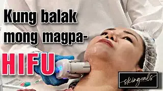 HIFU TREATMENT/ Proseso,presyo and after-care/Best Finds TV