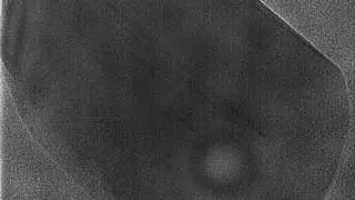 Surface Dynamics of a Catalyst Nanoparticle