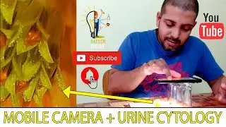 Mobile camera to urine cytology amazing flower !!!