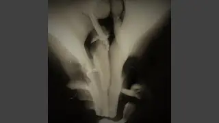 One Thousand Dreams