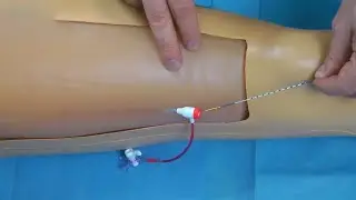 Introduction to the use of EVLT accessories