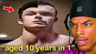 Steroids Are Making These Kids Age Like Milk..