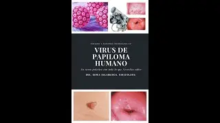 video Clase 1 Que es VPH