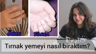 TIRNAK YEMEYİ NASIL BIRAKTIM?/ tırnak kemirmek nasıl bırakılır?