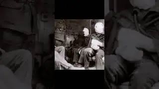 The effects of mustard gas #ww1 #warhistory #warshorts #military