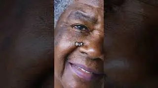 Can Stress Turn Your Hair Gray? 🧑&zwj;🦳