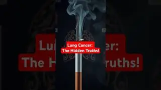 Lung Cancer: The Hidden Truths! #LungCancerAwareness #CancerResearch #SmokingRisks #EarlyDetection