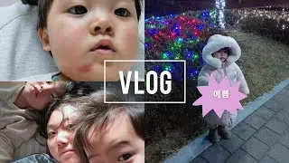 아기가 다쳤어요! ㅠㅠ 미운 네살 지나서 미친 다섯살 ㅋㅋ 화장하고 구두신는 딸내미 육아 브이로그
