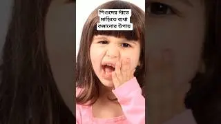 শিশুদের দাঁতে মাড়িতে ব্যথা কমানোর হোমিওপ্যাথি মেডিসিন #yoghomoeo #viral #shorts
