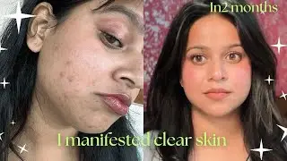 How I manifested clear skin 